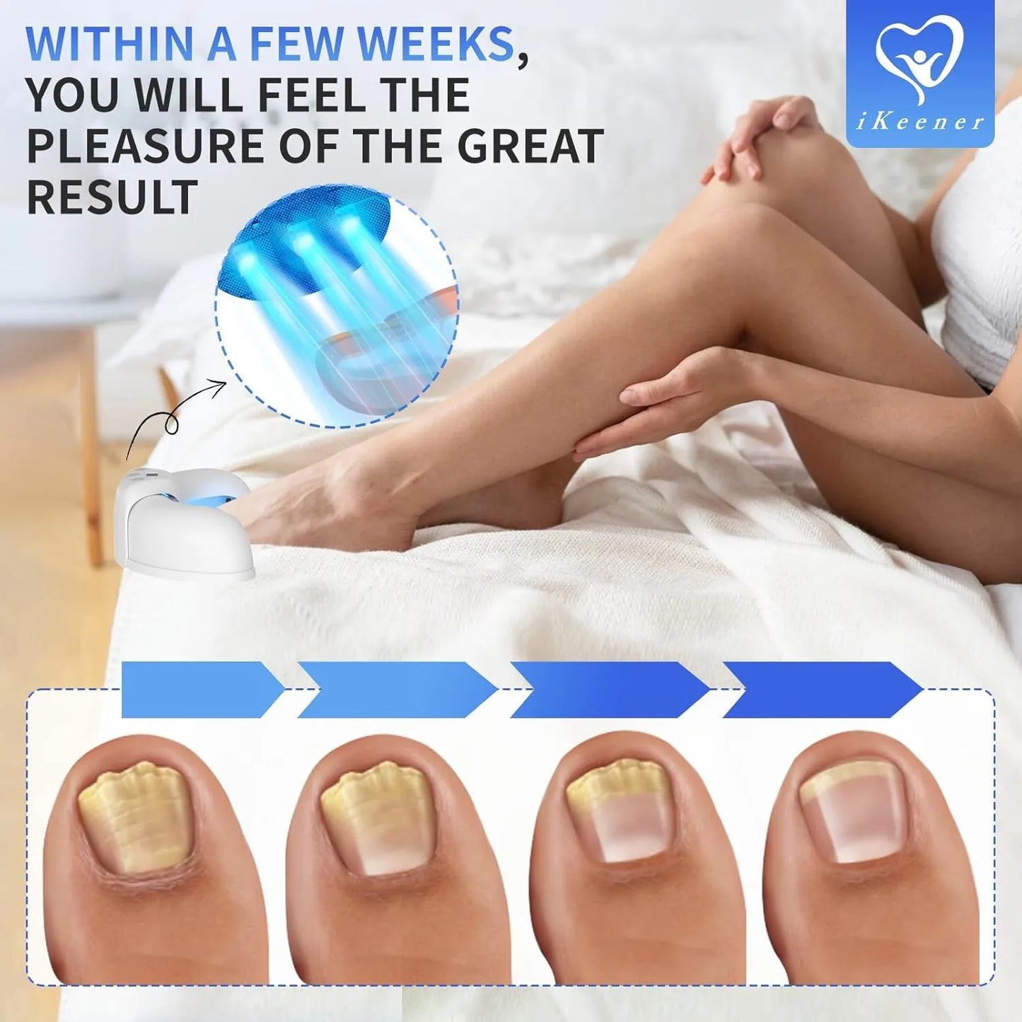 iKeener Nail Fungus Laser Device 8x910nm 14x470nm Cure Onychomycosis Toenail Fingernail Fungal Therapy Device Time display