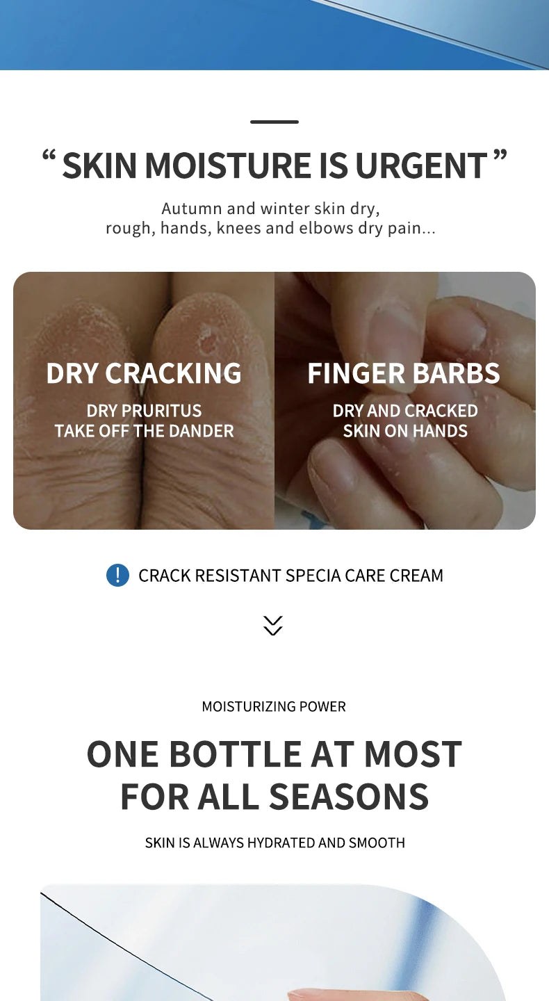 Anti Crack Foot Cream For Dry And Cracked Feet And Heels, Moisturizing Dry Feet And Heels, Preventing Your Feet From Cracking